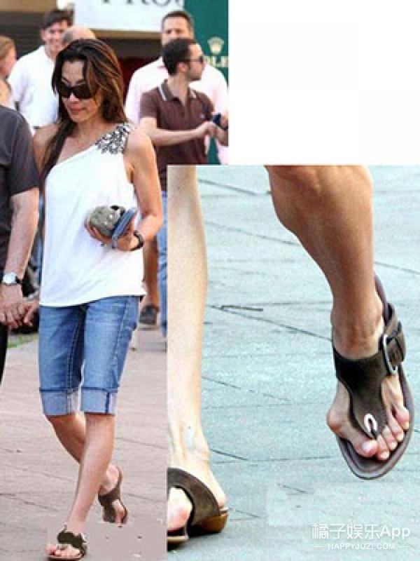 女明星的脚趾头最美_容祖儿拇指外翻_贝嫂拇指外翻手术